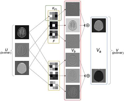 Linear fine-tuning: a linear transformation based transfer strategy for deep MRI reconstruction